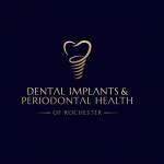 DENTAL IMPLANTS And PERIODONTAL HEALTH