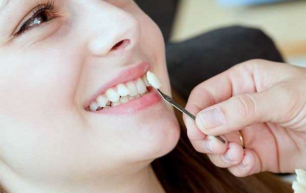 Best Dentists Service in Christchurch