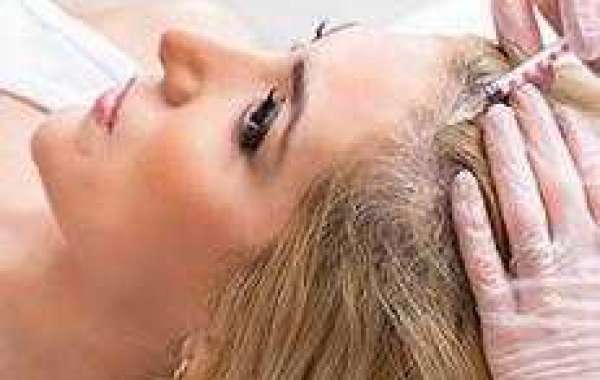 PRP Treatment Los Angeles