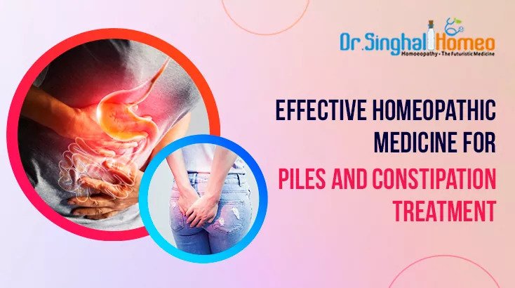 Can Homeopathy Provide Lasting Relief for Piles Problem? - AtoAllinks