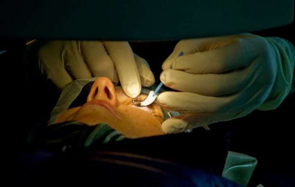Understanding Insurance Coverage for LASIK Eye Surgery