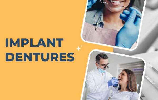 A New Dawn for Dental Restoration: Implant Dentures Shine in Richmond