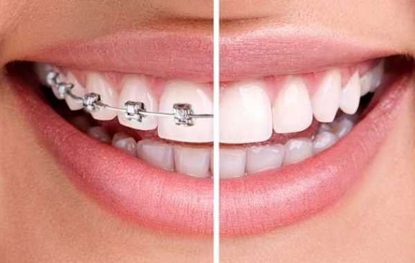 Your Guide to Finding the Best Dentist for Your Needs