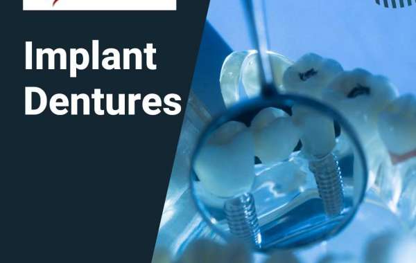 Affordable Dentures Repair in Abbotsford: Quality Care for Your Smile