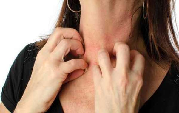 The Ultimate Guide to Skin Allergies Insights from Delhi’s Top Dermatologist