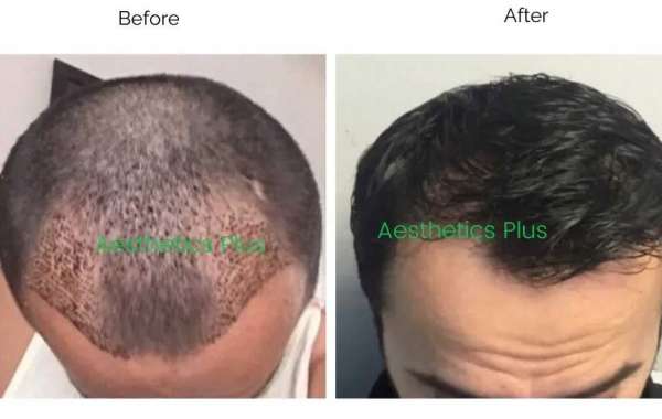Leading Hair Stylists in New Delhi for Stunning Makeovers