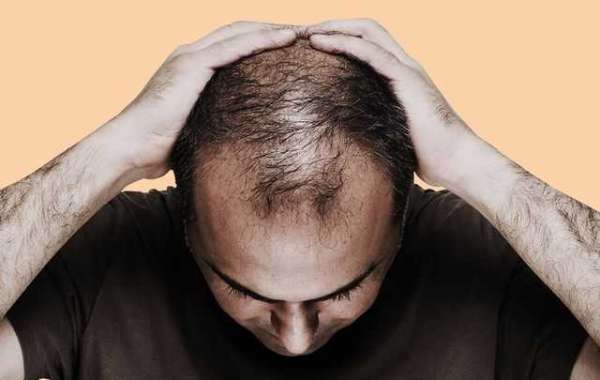 Understanding the Hair Transplantation Process: A Thorough Guide