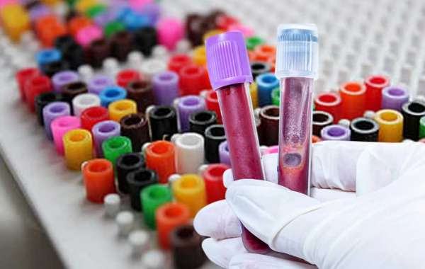 Blood Collection Tubes Market Expands with Growing Focus on Early Disease Detection