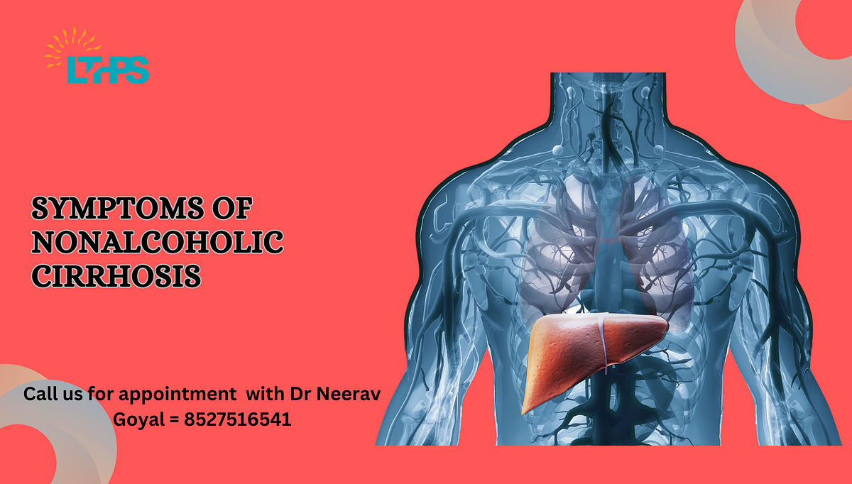 Symptoms of Nonalcoholic Cirrhosis | by Transplantationliver | Nov, 2024 | Medium