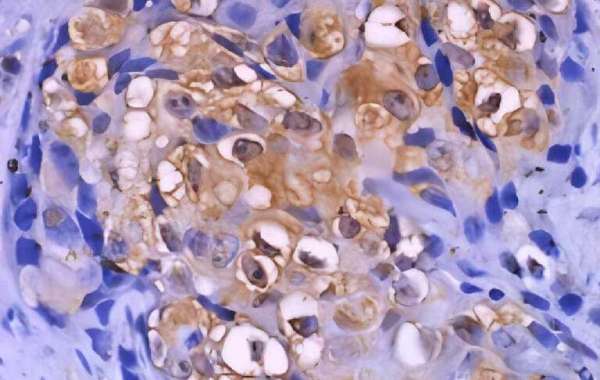 DS IHC Kits for Human and Rodent Tissues
