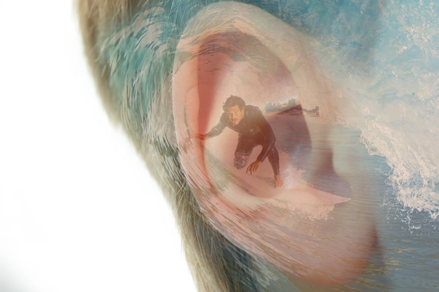 Surfer's Ear Treatment & Surgery | Ventura ENT Clinic