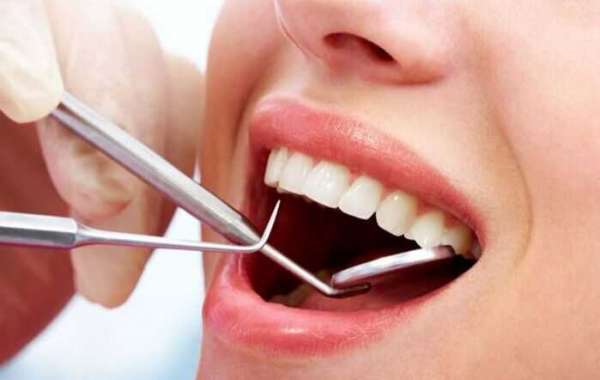 The Importance of General Dentistry: A Comprehensive Guide to Quality Dental Care in Dubai