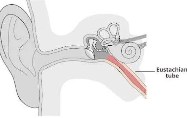 Expert Ear Care for Eustachian Tube Dysfunction at Veekay Clinic, Vasant Kunj