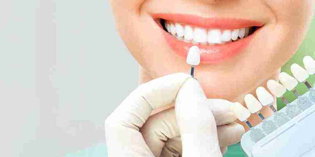 How to Choose the Right Cosmetic Dentist for Your Needs