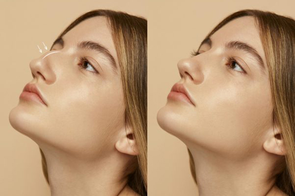 Best Cosmetic and Plastic Surgeons in UAE | Bioclinic