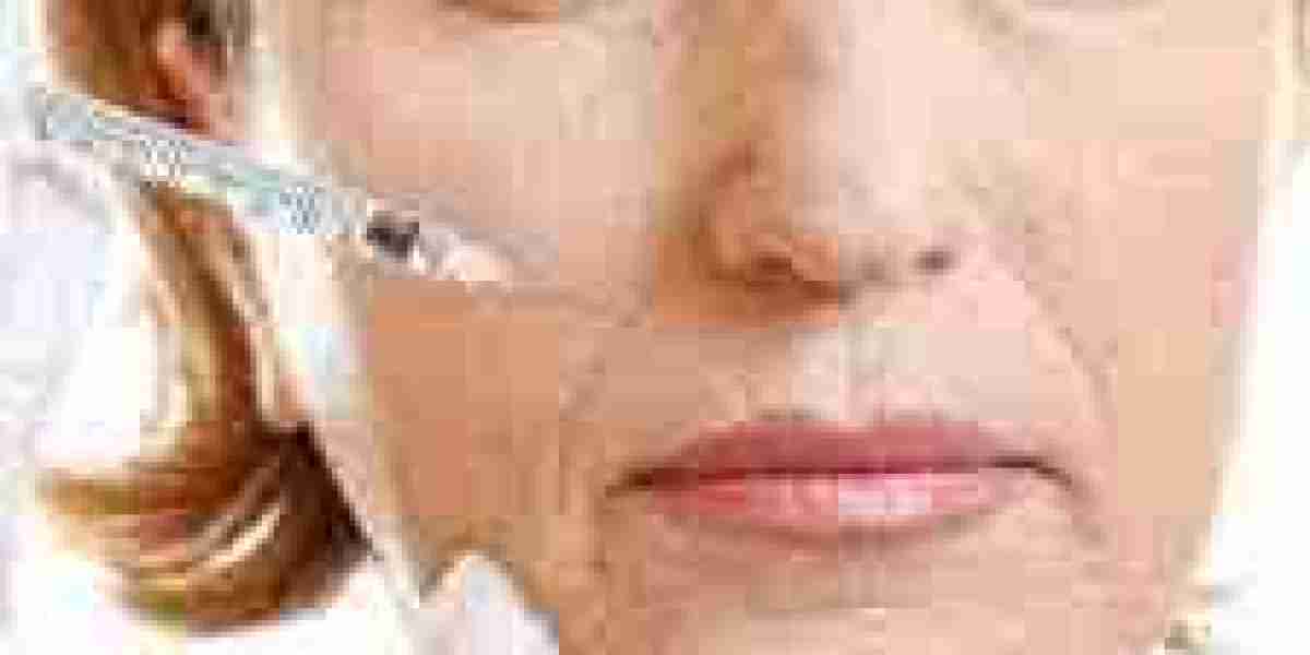 Safe & Professional Botox Injections in Riyadh