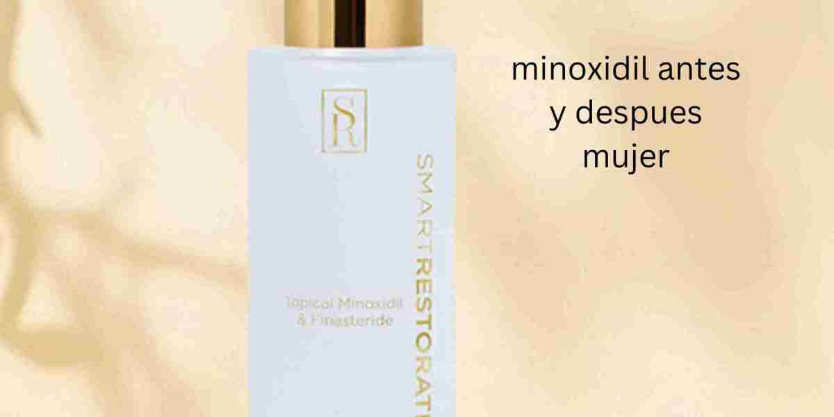 minoxidil antes y despues mujer
