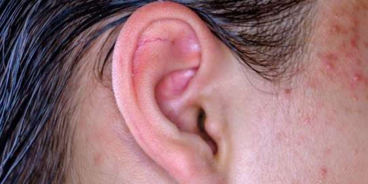 Specialized Care for Ear Infections and Furuncles by Leading ENT Doctors