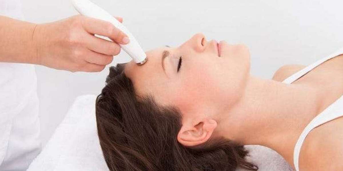 The Shift from Waxing: Why Women Are Choosing Permanent Hair Removal Treatments
