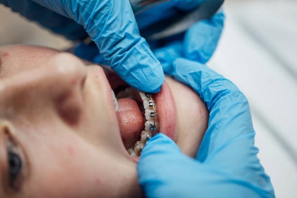 Braces That Bring Confidence: Why Cypress Is Smiling Big – Towneortho