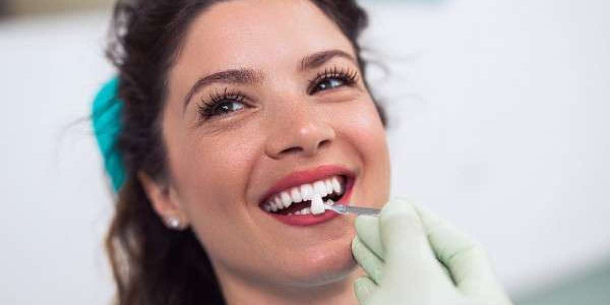 Brighten Your Smile: Whitening Tips That Actually Work