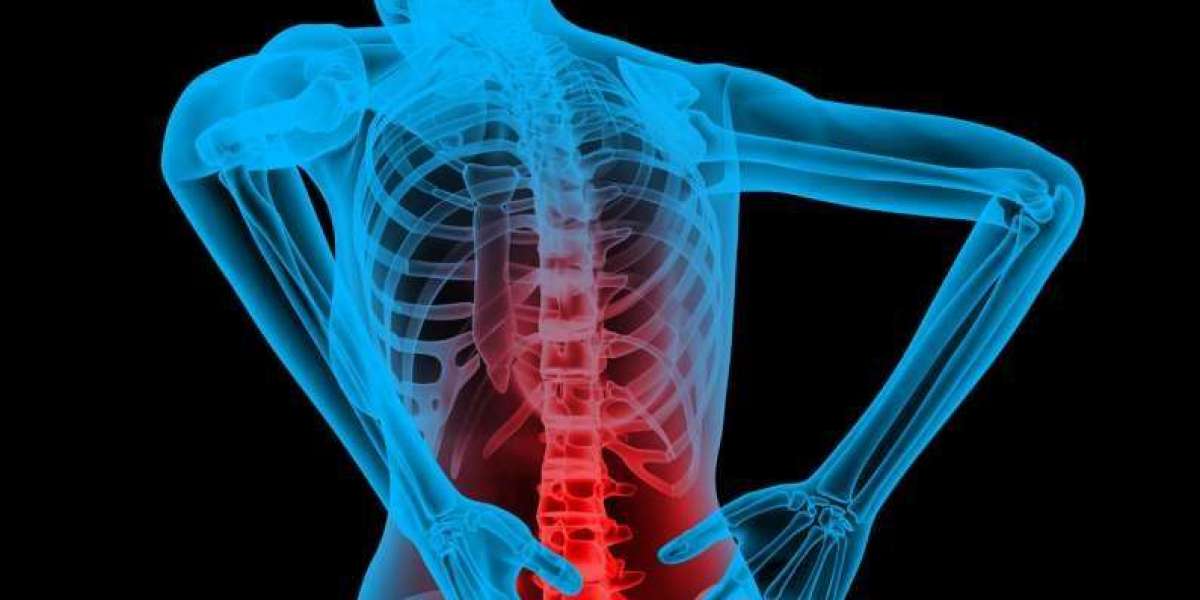 Aspadol 150 mg (Tapentadol) – A Strong Opioid Analgesic Explained