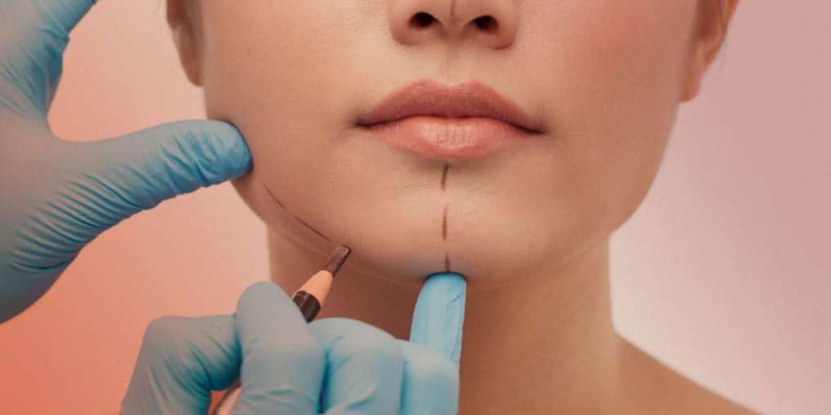 How to Fade Scars After Plastic Surgery Naturally