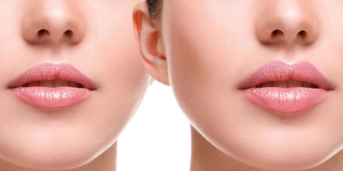 Best-Rated Clinics for Lip Fillers in Islamabad Reviewed