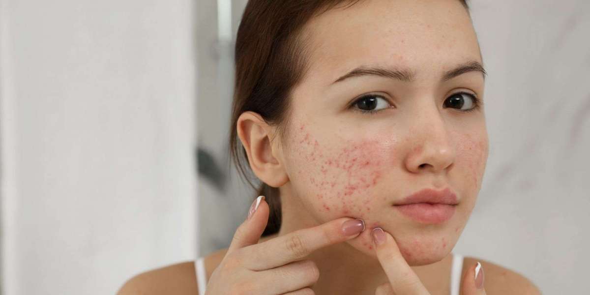 Restore Confidence Through Expert Skin & Hair Treatments: Solutions for Scars and Alopecia