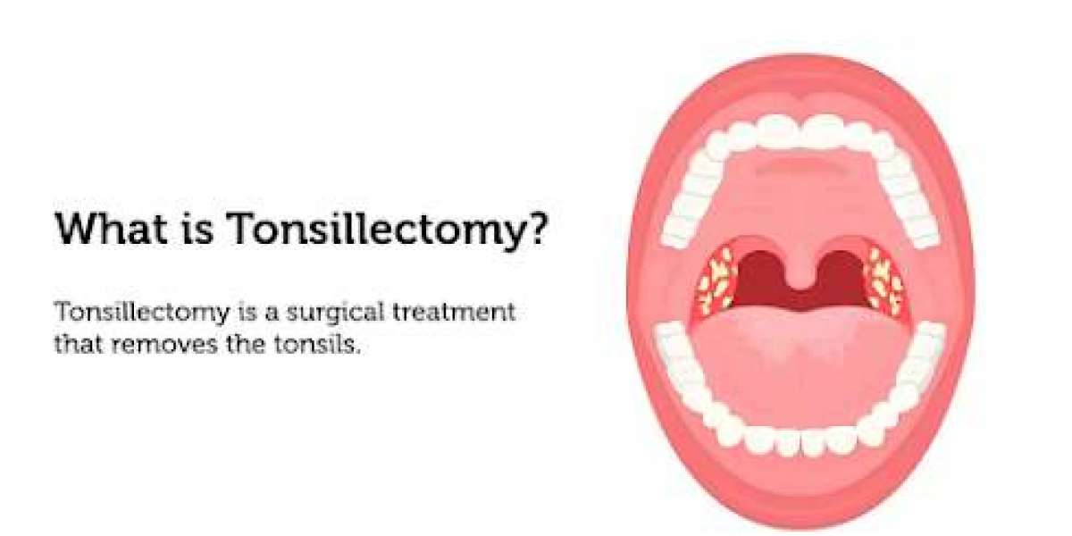 Tonsils Treatment Made Easy with Expert ENT Care in Vasant Kunj