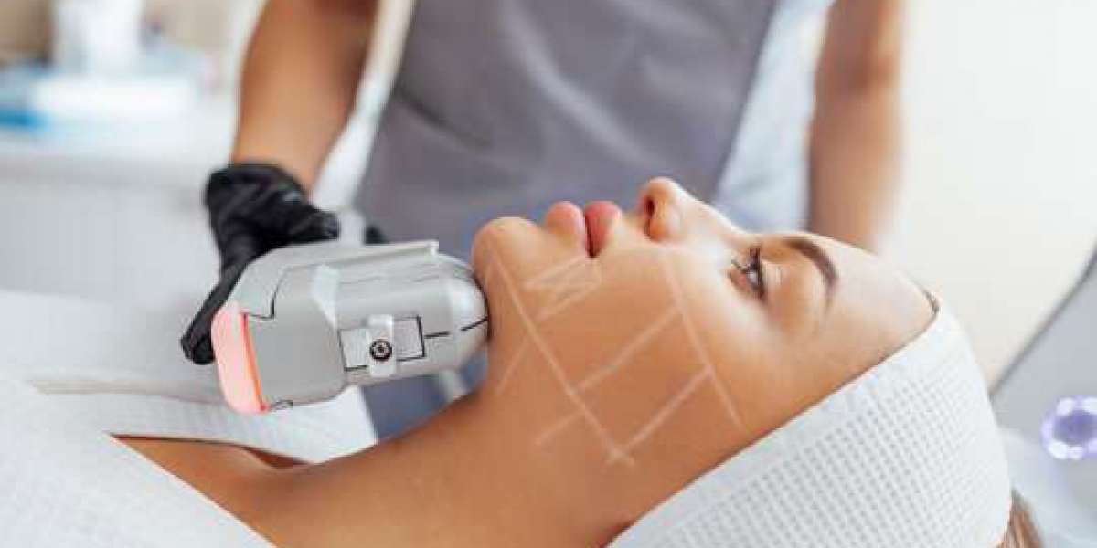 How Ultrasound Skin Tightening in Islamabad Works