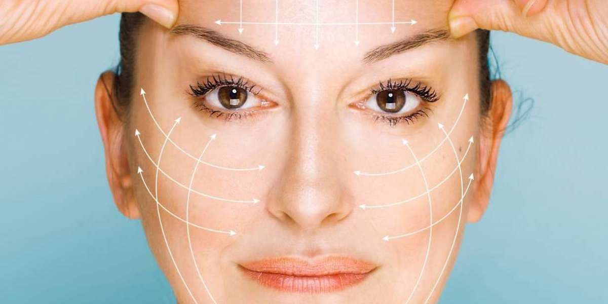 Thread Lift Before and After: Real Patient Results in Islamabad