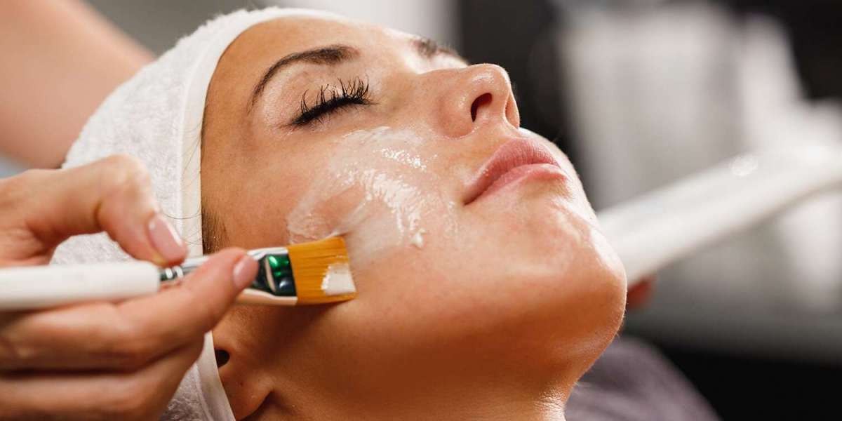 Can a Chemical Peel Remove Acne Scars Effectively?