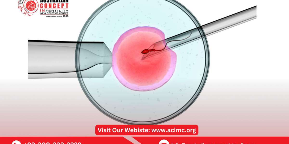 Who is the Best Candidate for ICSI Treatment
