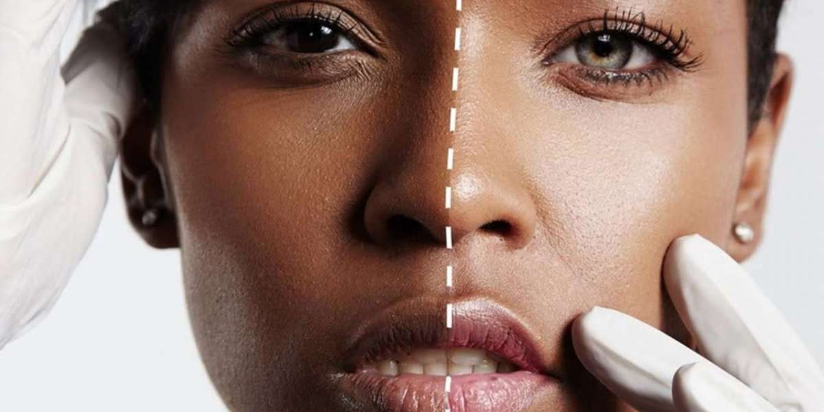 What to Ask Before Getting Skin Whitening Treatment in Islamabad