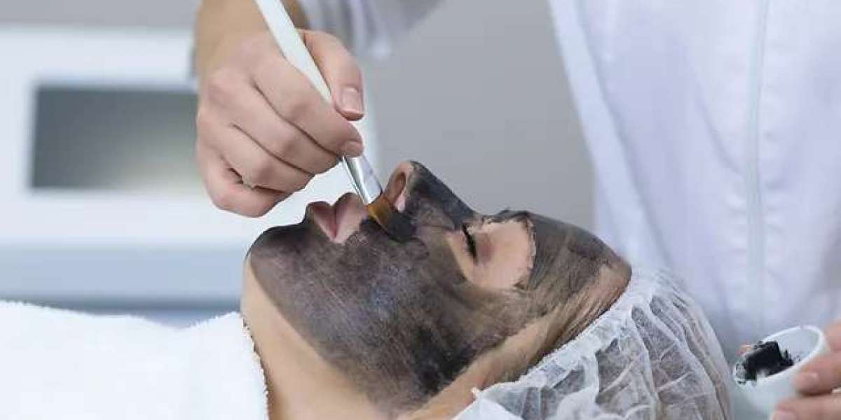 Common Side Effects of Laser Carbon Peel and How to Manage Them