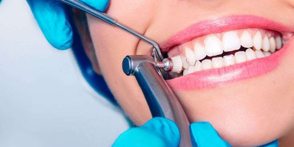 Teeth Cleaning In Jumeirah Zenon Dental Clinic
