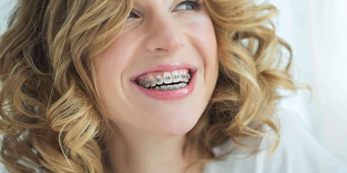 Achieve Your Perfect Smile with Invisalign and Skilled Dentists