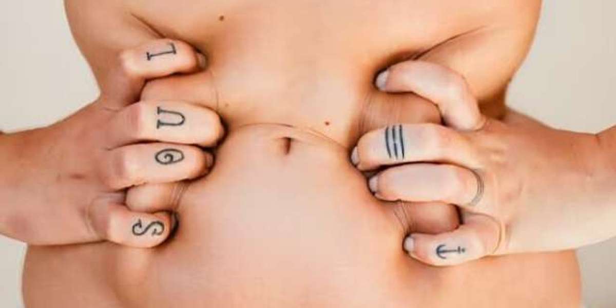 Latest Advances in Tummy Tuck Surgery in Islamabad