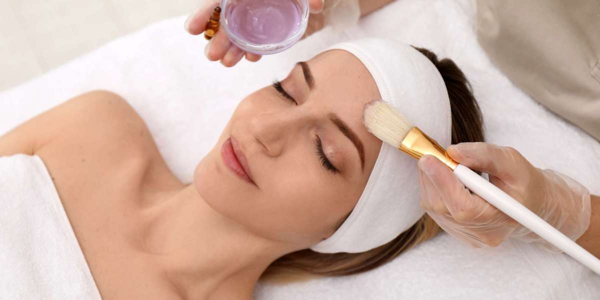 Why Chemical Peels Are Gaining Popularity in Islamabad