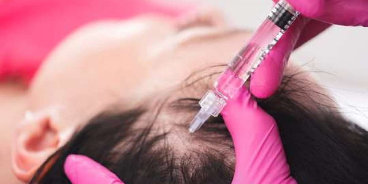 Clinics Offering Multiple PRP Sessions for Hair Regrowth in Islamabad: What to Expect