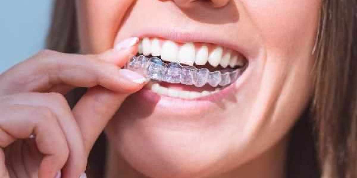 Fast Action for Sudden Tooth Issues in Hounslow