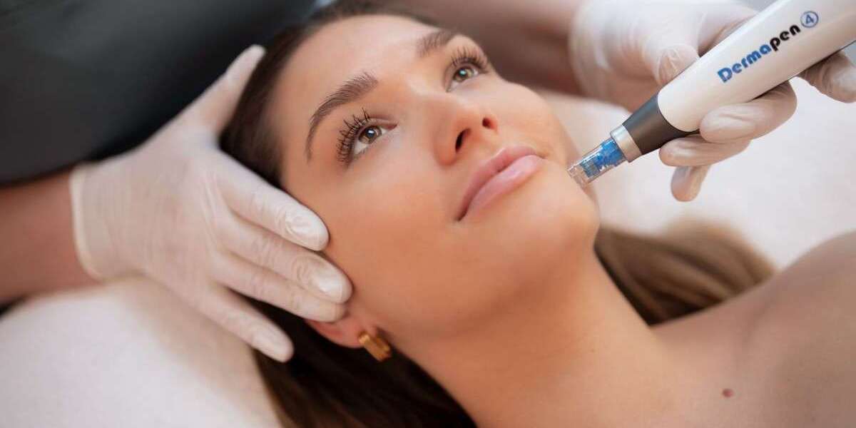 Prepping Your Skin for Dermapen: Do’s and Don’ts