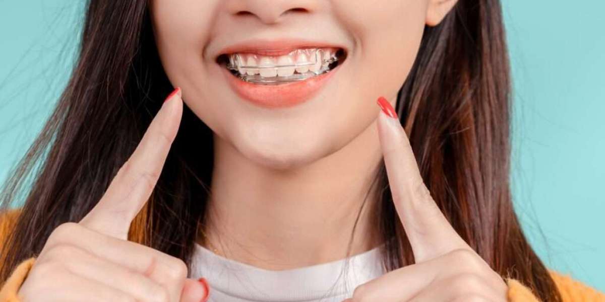 Signs Your Dental Retainer Needs Replacement