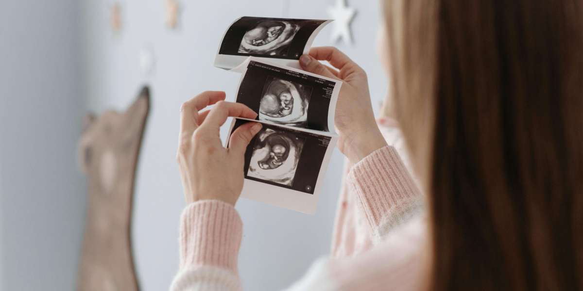 4D Ultrasound Katy: Clear Images, Unforgettable Experience