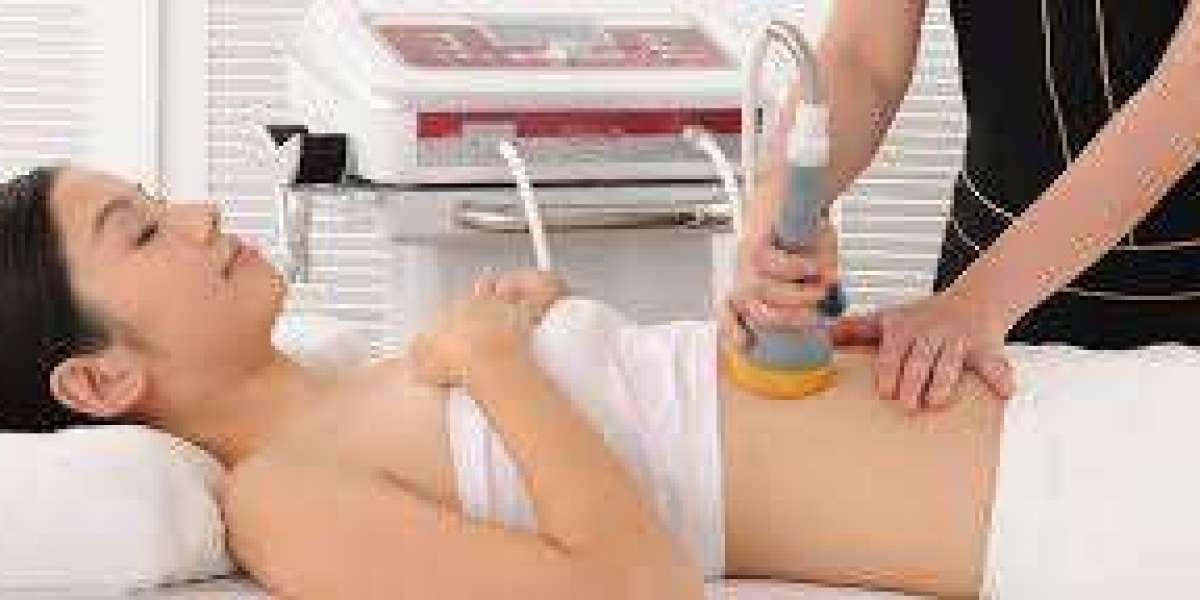 U Lipo Treatment and Non Surgical Liposuction: The Modern Way to Sculpt Your Body