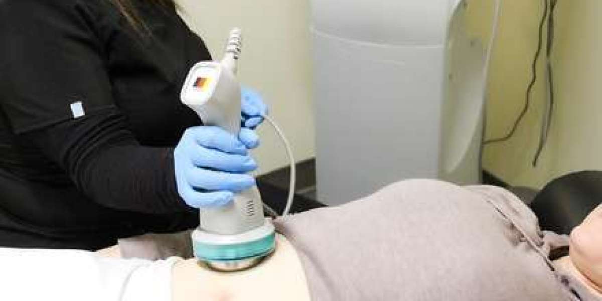 Laser Liposuction in Dubai: Procedure Steps