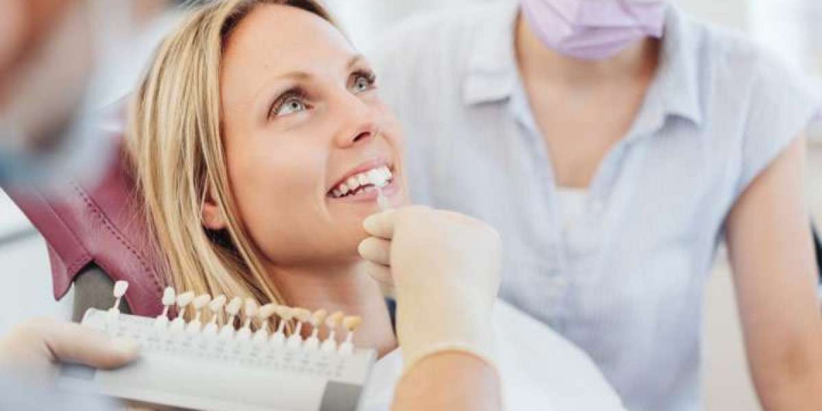 Composite Veneers vs. Porcelain Veneers: Which Should You Choose
