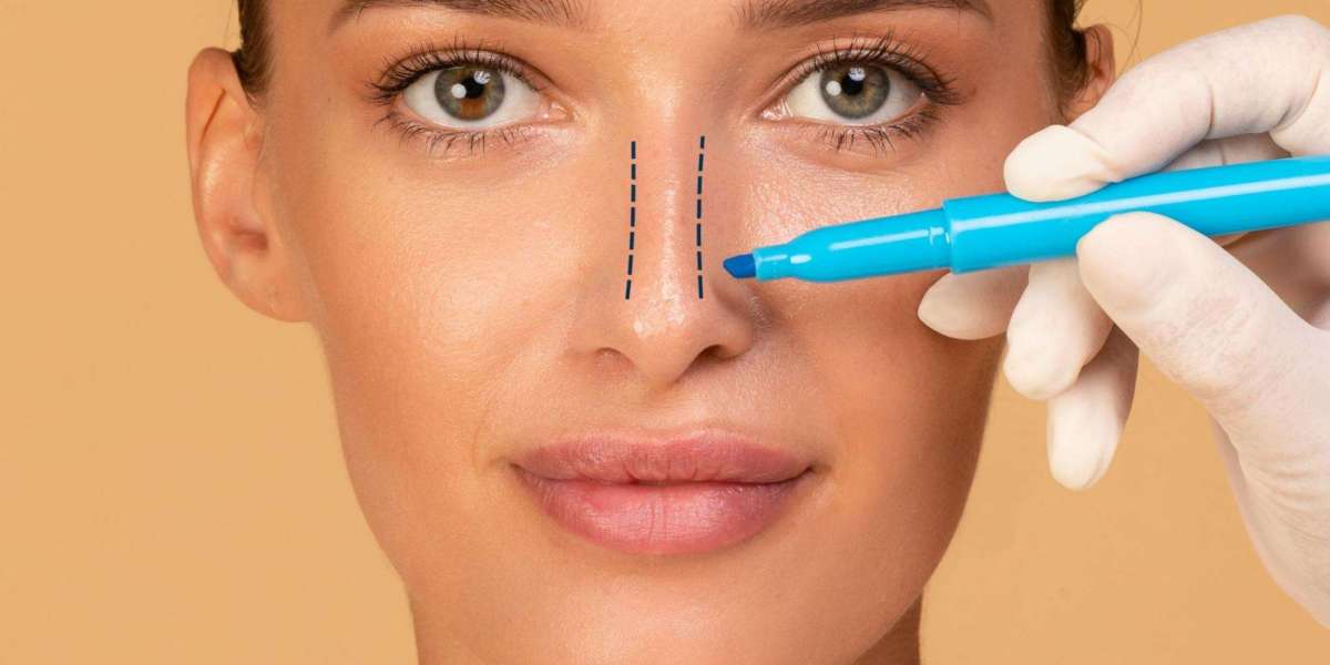 Rhinoplasty Surgery for Functional Improvements Beyond Aesthetics