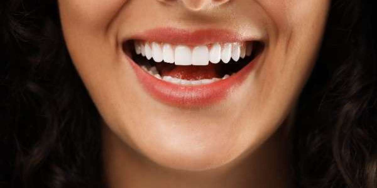 Expert-Backed Methods for Keeping Your Teeth White Longer